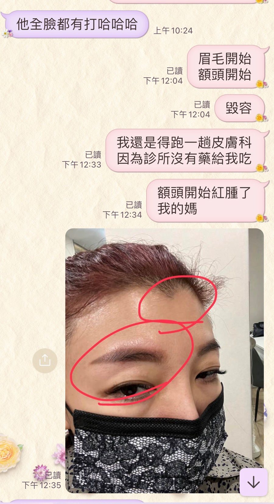 皮膚嚴重大過敏/愛X麗醫美診所 - 第6張圖 皮膚嚴重大過敏/愛X麗醫美診所