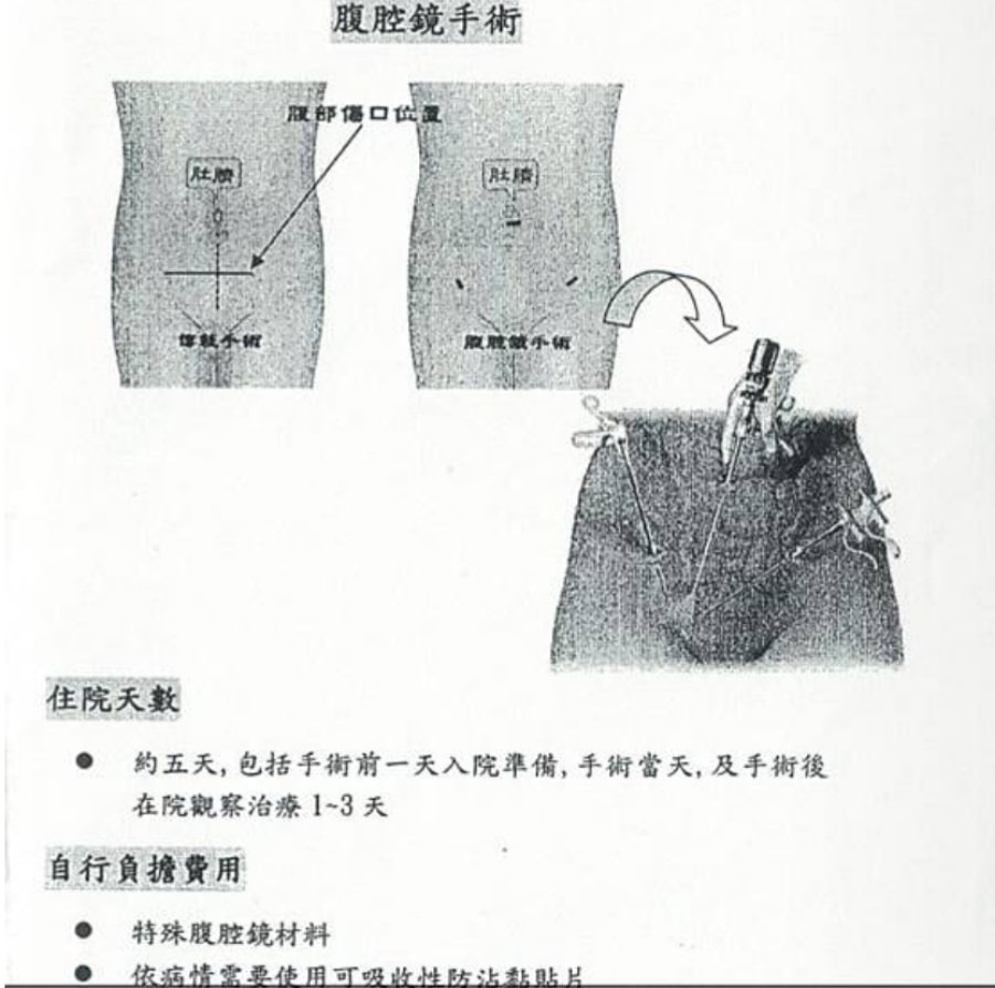 一定要腹腔鏡手術嗎?/巧克力囊腫可以不開刀??!!子宮內膜異位症 - 第3張圖 一定要腹腔鏡手術嗎?/巧克力囊腫可以不開刀??!!子宮內膜異位症