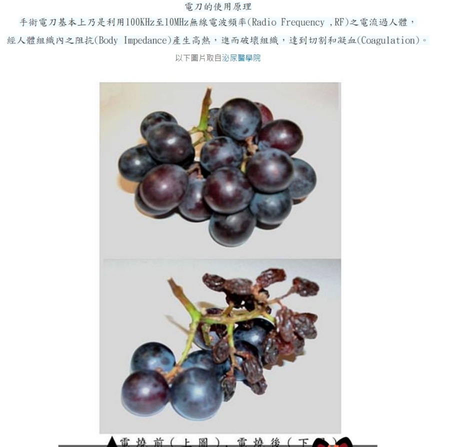 一定要腹腔鏡手術嗎?/巧克力囊腫可以不開刀??!!子宮內膜異位症 - 第4張圖 一定要腹腔鏡手術嗎?/巧克力囊腫可以不開刀??!!子宮內膜異位症