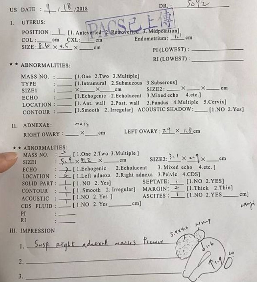 一定要腹腔鏡手術嗎?/巧克力囊腫可以不開刀??!!子宮內膜異位症 - 第7張圖 一定要腹腔鏡手術嗎?/巧克力囊腫可以不開刀??!!子宮內膜異位症
