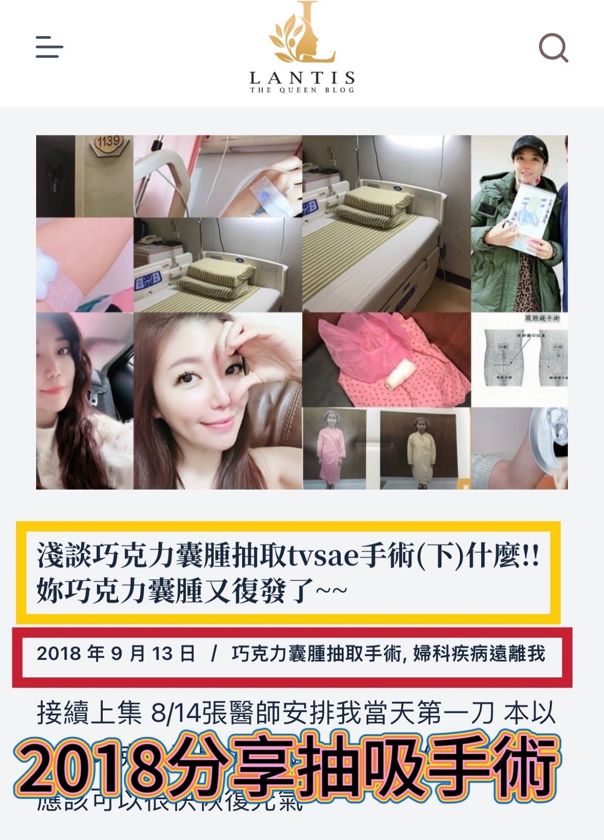 意外成為部落客/登革熱事件爆發引起身體不適/抵抗、免疫力下降(一) - 第1張圖 意外成為部落客/登革熱事件爆發引起身體不適/抵抗、免疫力下降(一)