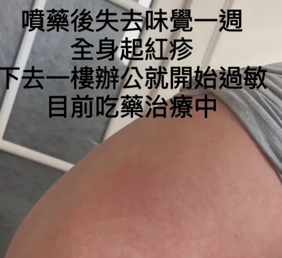 登革熱強制室內噴藥的必要性(二) - 第2張圖 登革熱強制室內噴藥的必要性(二)