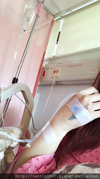 淺談巧克力囊腫抽取tvsae手術(下)什麼!!妳巧克力囊腫又復發了~~