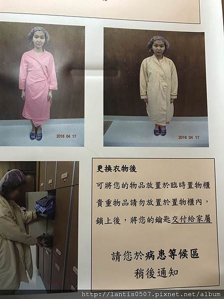 淺談巧克力囊腫抽取硬化手術與腹腔鏡手術/手術差異圖分享