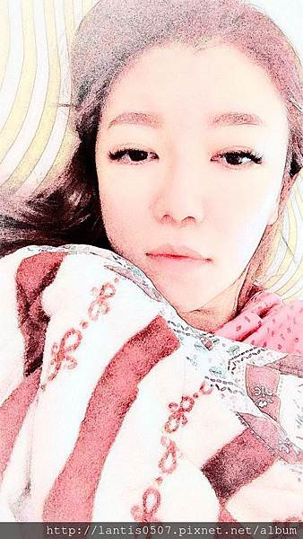 淺談巧克力囊腫抽取tvsae手術(下)什麼!!妳巧克力囊腫又復發了~~