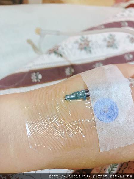 淺談巧克力囊腫抽取tvsae手術(下)什麼!!妳巧克力囊腫又復發了~~